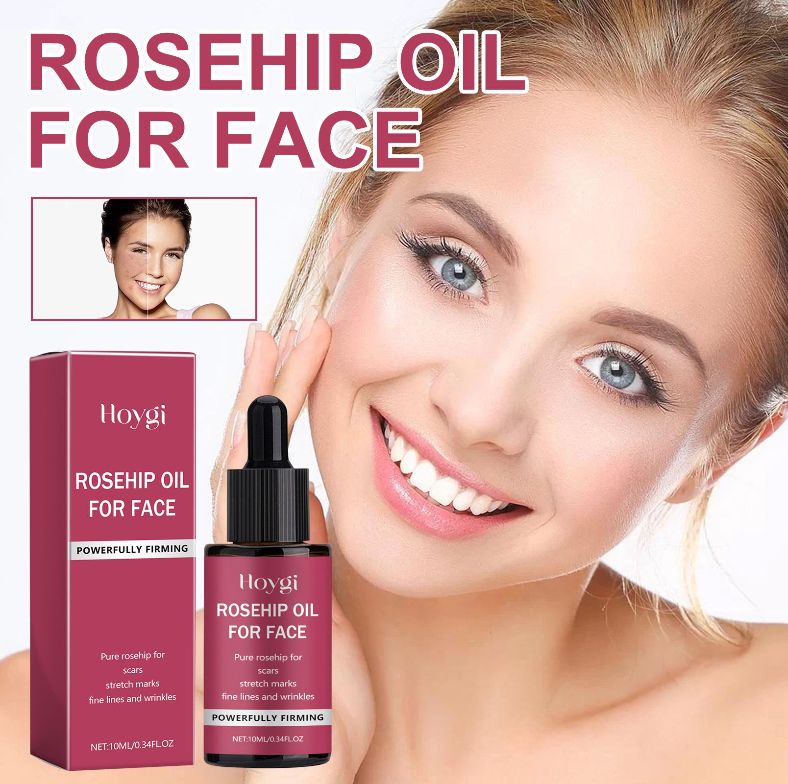 Seraphine Brightening Rosehip Oil